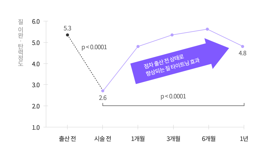 점차 출산 전 상태로 향상되는 질 타이트닝 효과